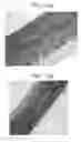 Fig. 25 - Leukolectins and uses thereof