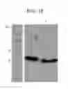 Fig. 35 - Leukolectins and uses thereof