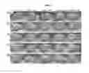 Fig. 04 - COMPOSITION COMPRISING FILLER AND BOTULINUM TOXIN FOR ALLEVIATING SKIN WRINKLES OR AGING OR TREATING NEUROMUSCULAR DISEASES