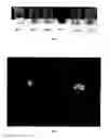 Fig. 02 - Radiolabelled material