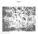 Fig. 02 - METHODS OF USE OF BIOMATERIAL AND INJECTABLE IMPLANT CONTAINING BIOMATERIAL