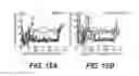 Fig. 13 - Methods and devices for cellular transplantation