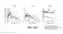 Fig. 14 - Methods and devices for cellular transplantation