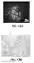 Fig. 16 - Methods and devices for cellular transplantation