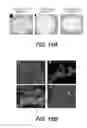 Fig. 18 - Methods and devices for cellular transplantation