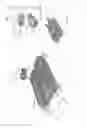 Fig. 05 - Apparatuses and methods for negative pressure wound therapy