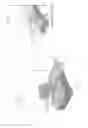 Fig. 16 - Apparatuses and methods for negative pressure wound therapy