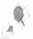 Fig. 17 - Apparatuses and methods for negative pressure wound therapy
