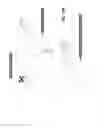Fig. 29 - Apparatuses and methods for negative pressure wound therapy