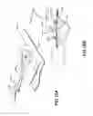 Fig. 45 - Apparatuses and methods for negative pressure wound therapy