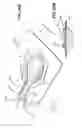 Fig. 46 - Apparatuses and methods for negative pressure wound therapy