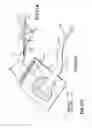 Fig. 47 - Apparatuses and methods for negative pressure wound therapy