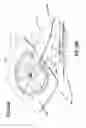 Fig. 49 - Apparatuses and methods for negative pressure wound therapy