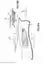 Fig. 50 - Apparatuses and methods for negative pressure wound therapy