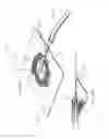 Fig. 76 - Apparatuses and methods for negative pressure wound therapy
