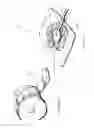 Fig. 81 - Apparatuses and methods for negative pressure wound therapy
