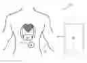 Fig. 01 - Implantable heart pump controller