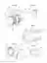 Fig. 04 - Drug delivery device