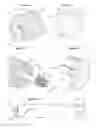 Fig. 06 - Drug delivery device