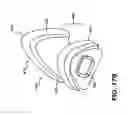 Fig. 14 - BREATHING APPARTUS WITH NASAL INTERFACE