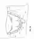 Fig. 15 - BREATHING APPARTUS WITH NASAL INTERFACE
