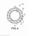 Fig. 06 - Introducer sheath for radial artery access