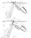 Fig. 07 - System for anchoring medical devices