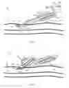 Fig. 09 - System for anchoring medical devices