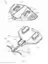 Fig. 10 - System for anchoring medical devices