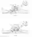 Fig. 11 - System for anchoring medical devices