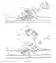 Fig. 12 - System for anchoring medical devices