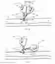 Fig. 13 - System for anchoring medical devices