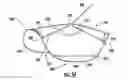 Fig. 15 - Vasculature closure devices and methods
