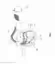 Fig. 02 - Active implantable device and MRI sensor suitable for use in an MRI scanner