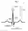 Fig. 02 - System and method for stimulating the heart using sub-threshold biphasic stimulation