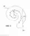 Fig. 04 - COCHLEAR IMPLANT SYSTEM