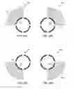 Fig. 31 - Unwrapped 2D view of a stimulation lead with complex electrode array geometry