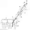 Fig. 01 - DENTAL TREATMENT DEVICE