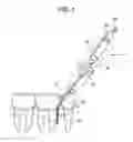 Fig. 02 - DENTAL TREATMENT DEVICE