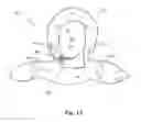 Fig. 11 - Disposable safety garment with improved neck closure