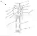 Fig. 01 - Tool and method for draining a fire sprinkler system and a fire sprinkler