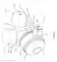 Fig. 05 - Adapter assembly for securing a precleaner to an air filtration system