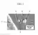 Fig. 02 - Spring steel with excellent fatigue resistance and method of manufacturing the same
