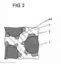 Fig. 03 - Composite magnetic material, coil component using same, and power supply device