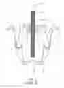 Fig. 04 - Puller