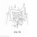 Fig. 10 - TENDON-ACTUATED ARTICULATING INSTRUMENTS, AND RELATED SYSTEMS