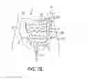 Fig. 11 - TENDON-ACTUATED ARTICULATING INSTRUMENTS, AND RELATED SYSTEMS