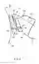 Fig. 04 - HAIR CLIPPER AND METHOD OF FORMING THE SAME