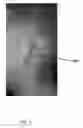 Fig. 02 - Method of manufacture of a surgical model for an anatomical feature