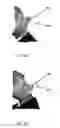 Fig. 06 - Method of manufacture of a surgical model for an anatomical feature